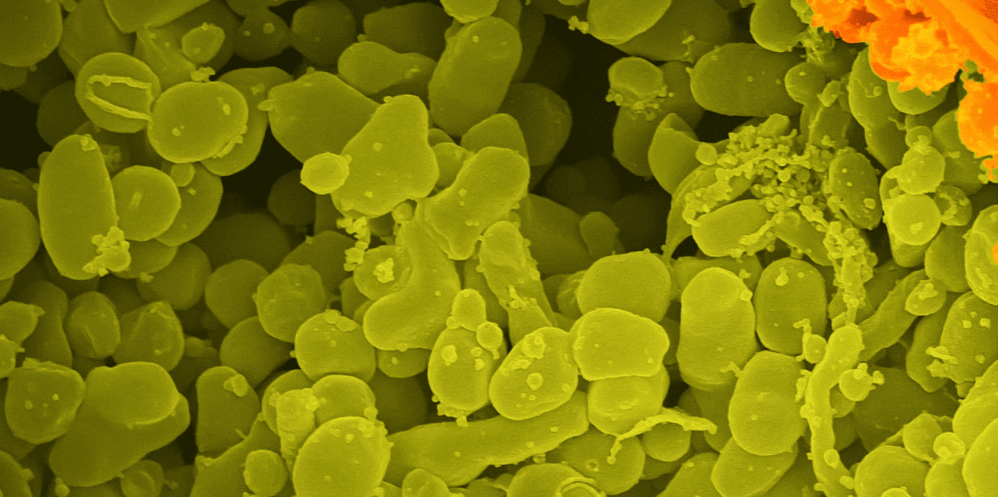 Nanoparticles can tackle antimicrobial resistance