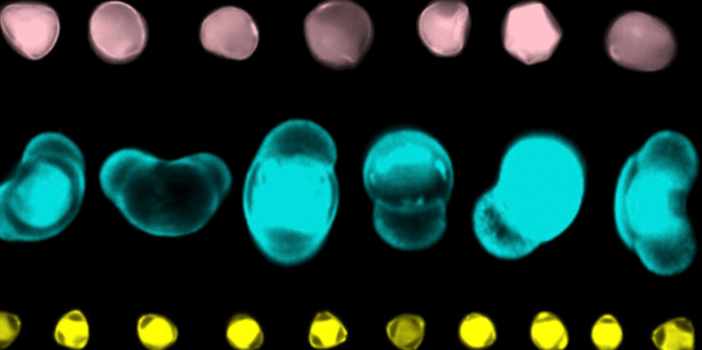 Understanding environmental change through AI-powered pollen analysis